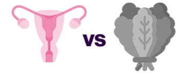 Illustration of a uterus versus a grayscale head of lettuce.
