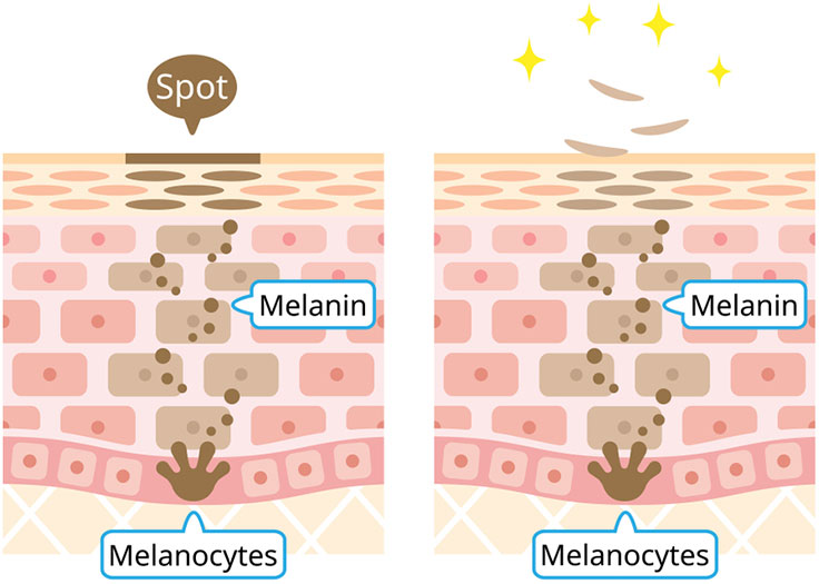 Diagram showing melanin production and skin spot fading with melanocytes labeled.