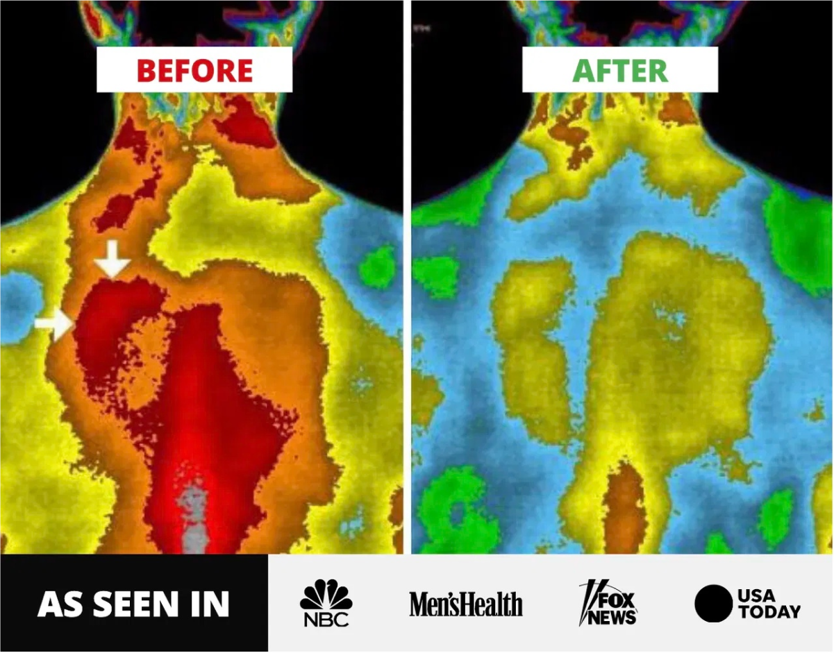 Thermal scan comparison showing before and after effects on neck and shoulders, with various heat color changes.