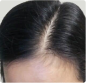 Close-up of black hair with a visible white root.