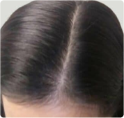 Top view of a person's head with neatly parted dark hair.