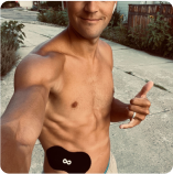 A shirtless person outdoors, showing a medical device attached to their abdomen.